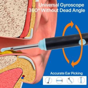 Rechargeable Smart Wireless Ear wax remover Camera Kit | Visual Ear Wax Removal Tool With Mobile Display | Random Colour 3 Rechargeable Smart Wireless Ear wax remover Camera Kit | Visual Ear Wax Removal Tool With Mobile Display | Random Colour